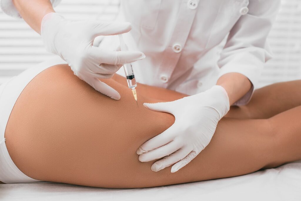 bioestimulador-colageno-gluteo