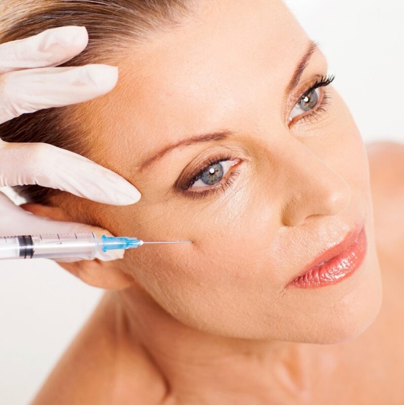 preenchimento-facial