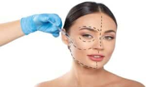 harmonizaçao-facial-preço