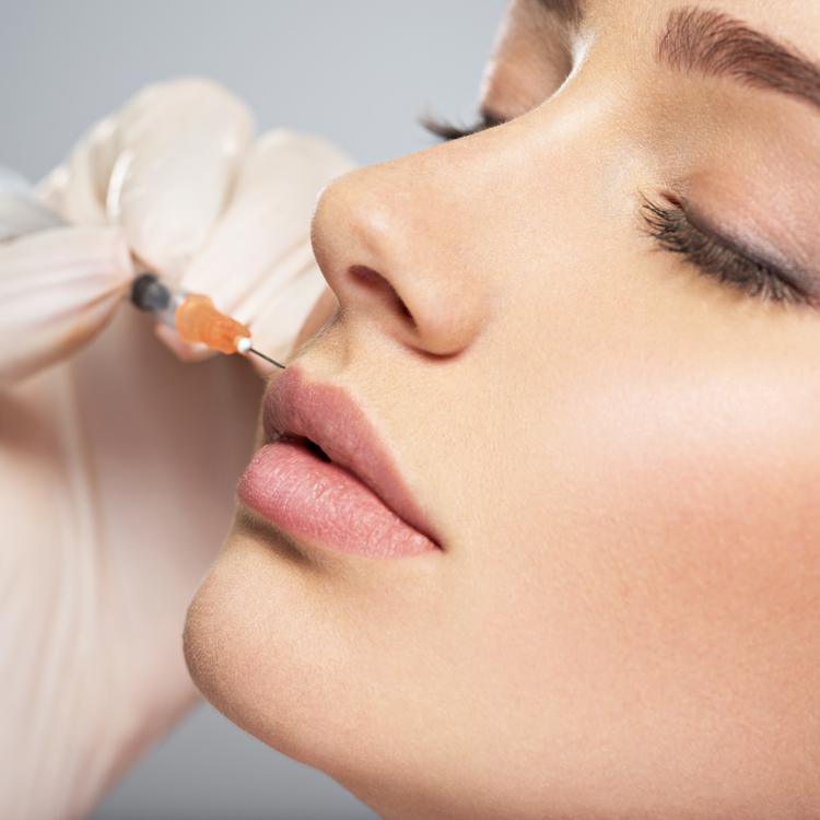 preenchimento_labial_tratamento