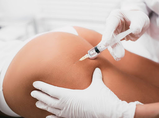 bioestimulador-no-gluteo