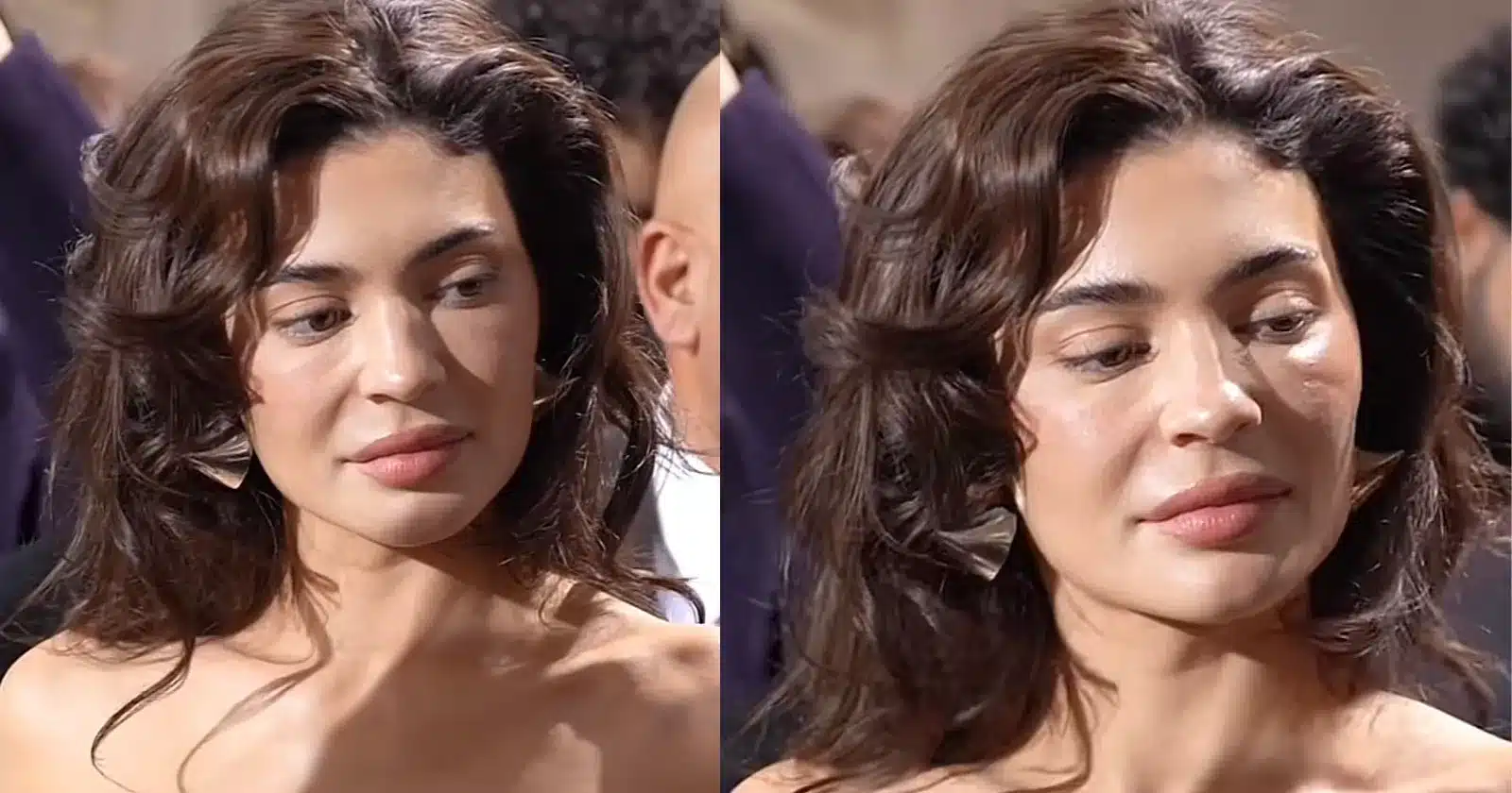 rosto-de-ozempic-kylie-jenner