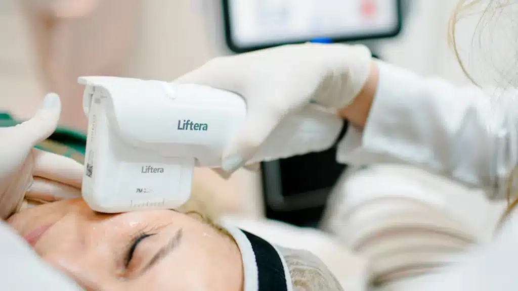 tratamento-liftera-1