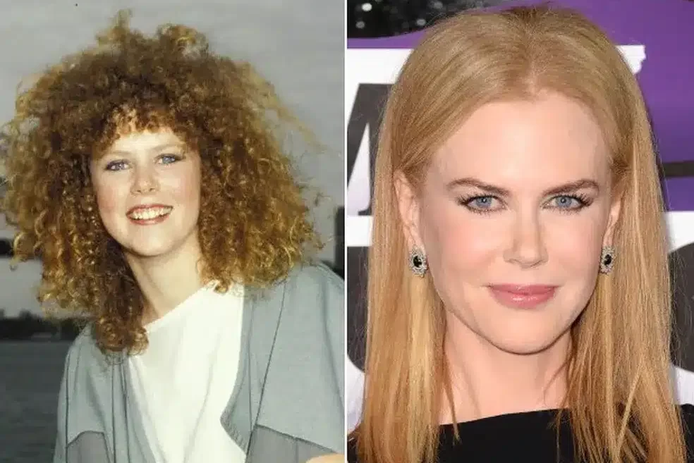 Nicole-Kidman-envelhecimento