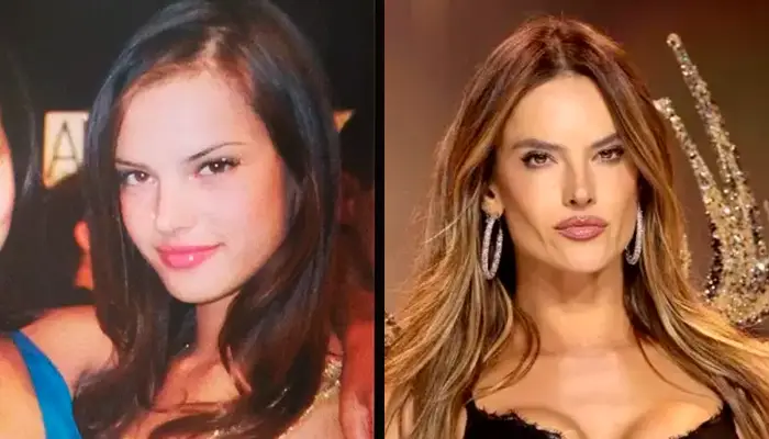 antes-e-depois-alessandra-ambrosio