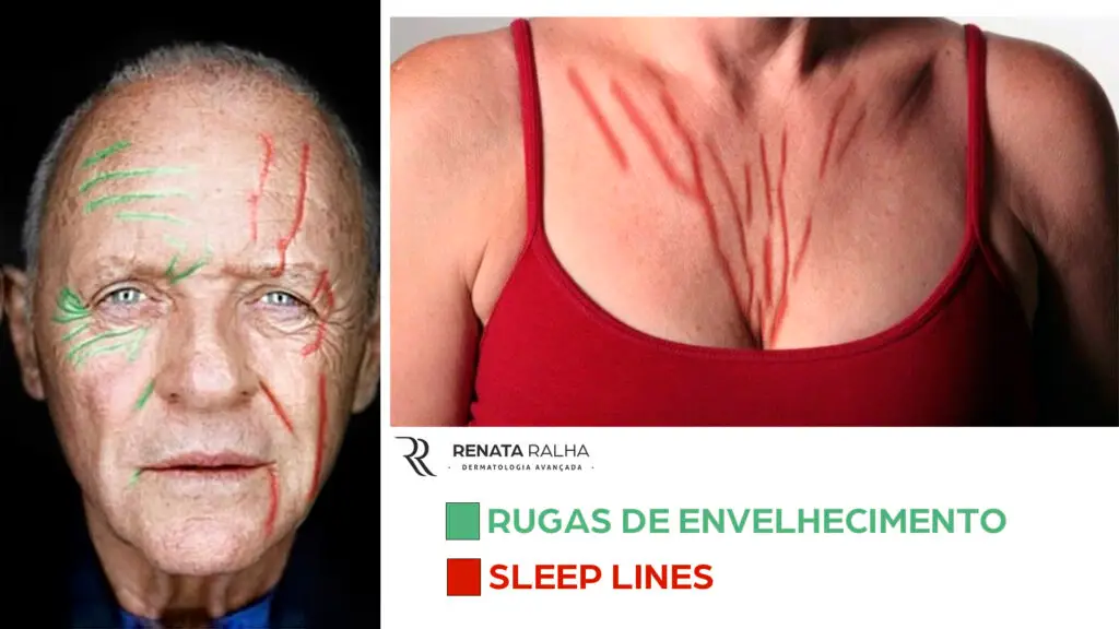 sleep-lines