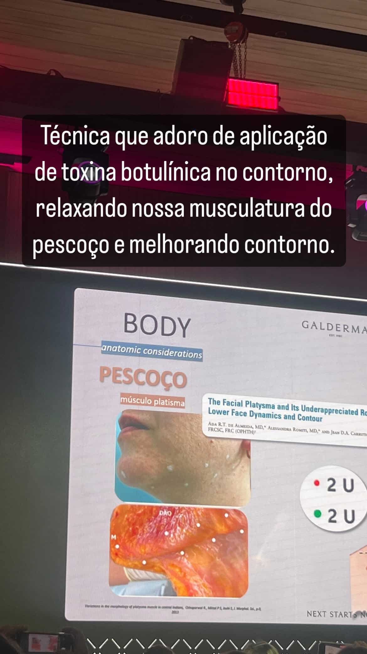 RENATA-STORY-CONGRESSO