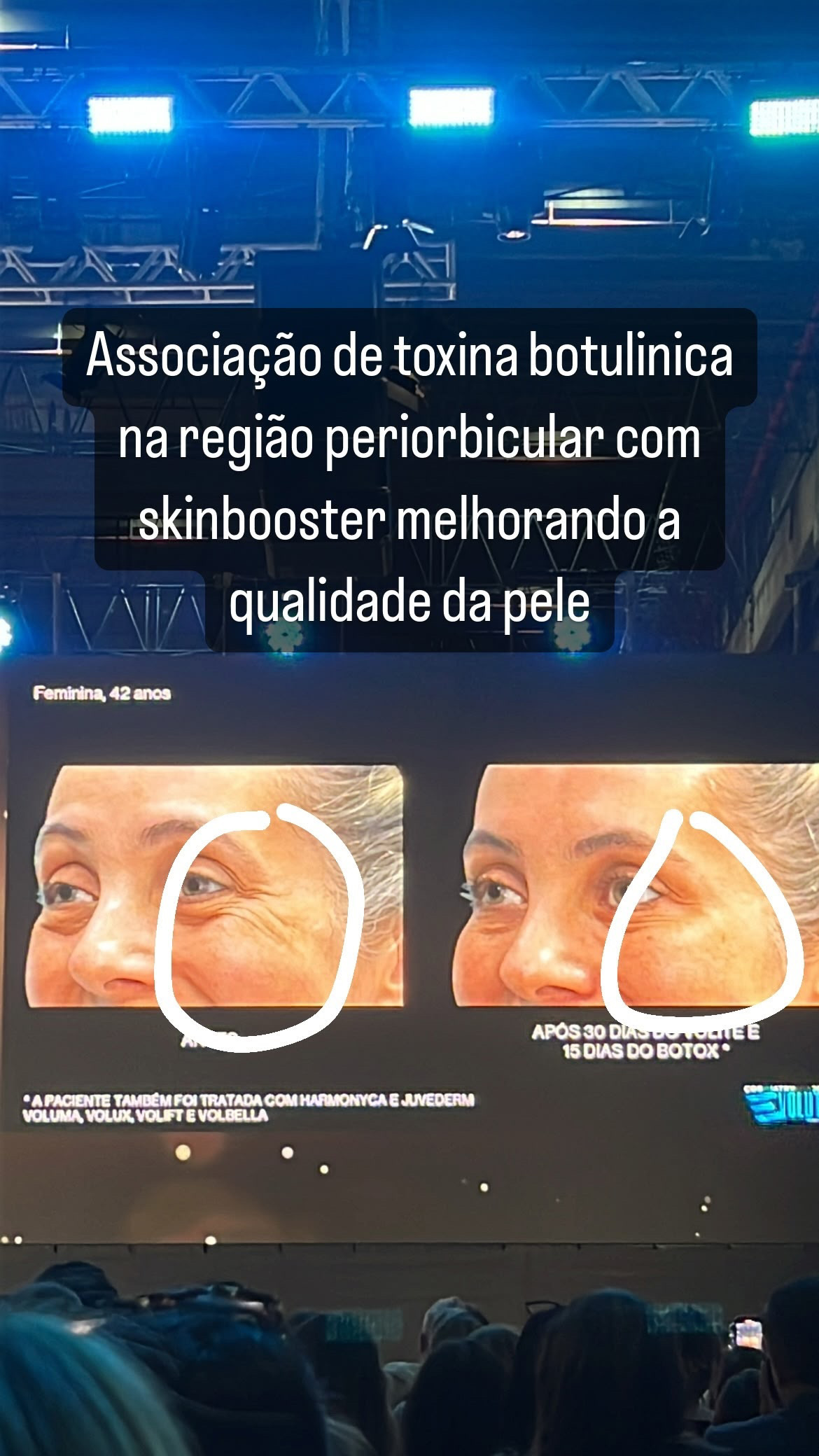 RENATA-STORY-CONGRESSO