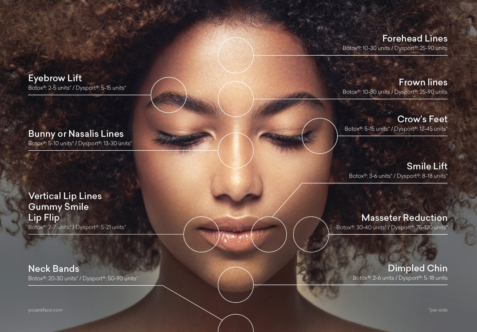face_diagram_BOTOX