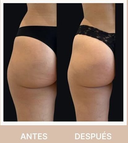 SnapInsta.to_482054388_17948503619938725_2589853474160639057_n