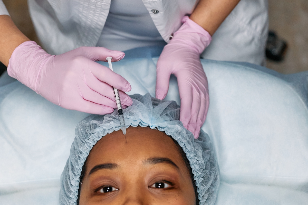 Testa com rugas de expressão antes e depois da toxina botulínica