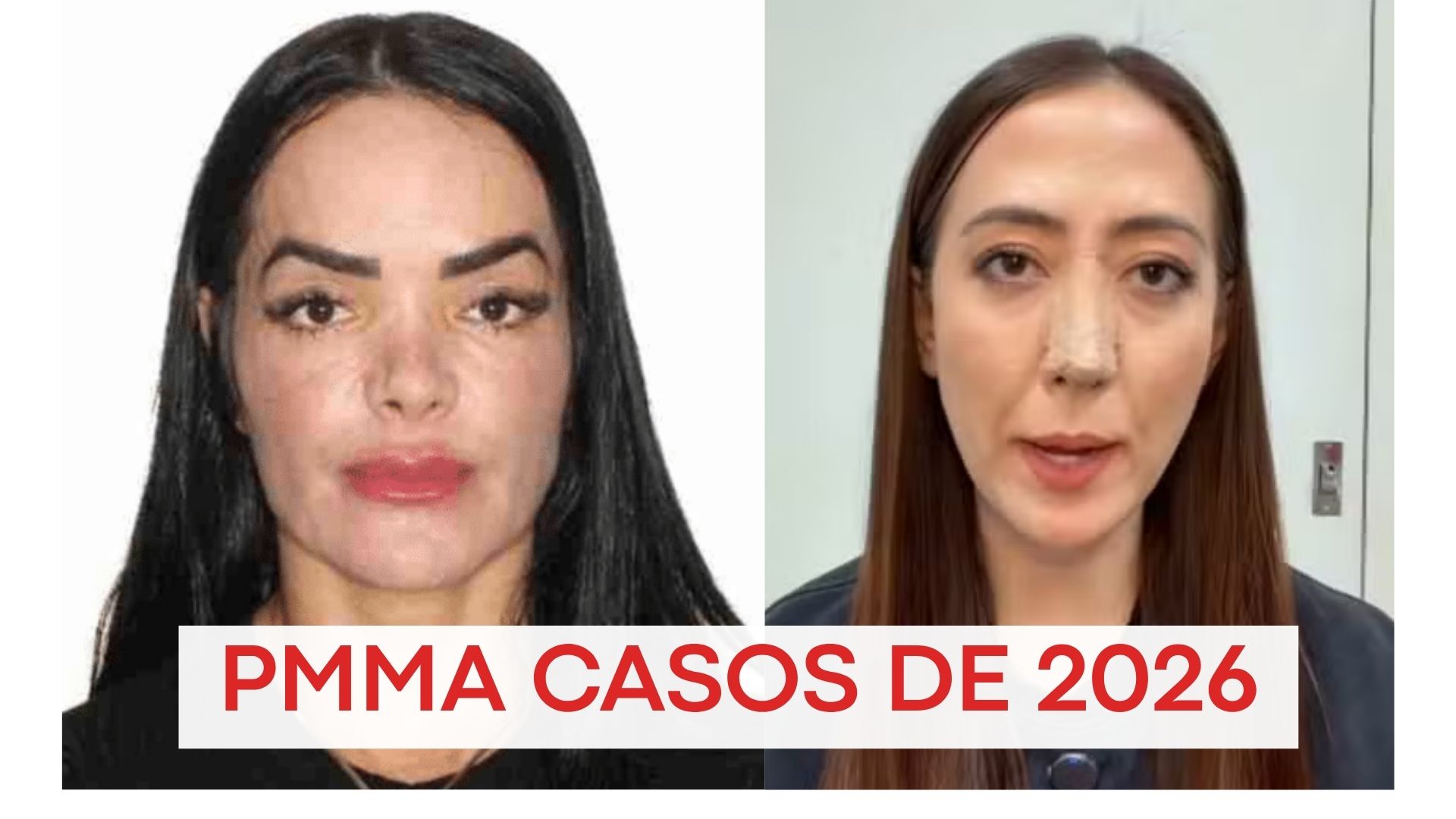 pmma-2026-riscos-complicacoes