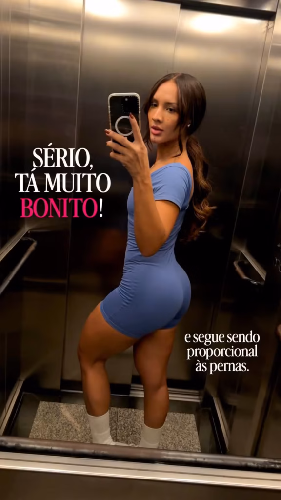 harmonizacao-gluteos-tati-barbieri-maxiane-bbb-26