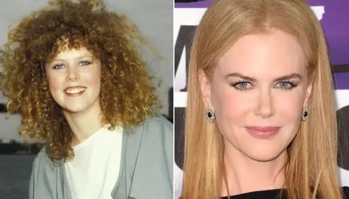 Nicole-Kidman-envelhecimento